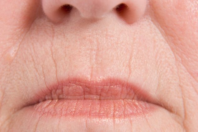 چروکهای عمیق اطراف لب