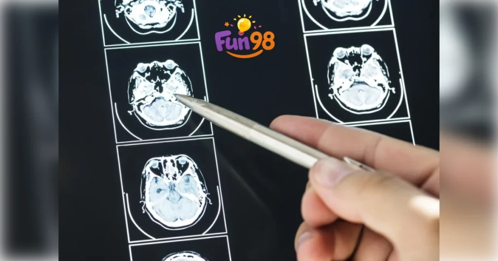 تشخیص آفازی؛ ام&zwnj;آرآی مغز و ارزیابی گفتاردرمانی