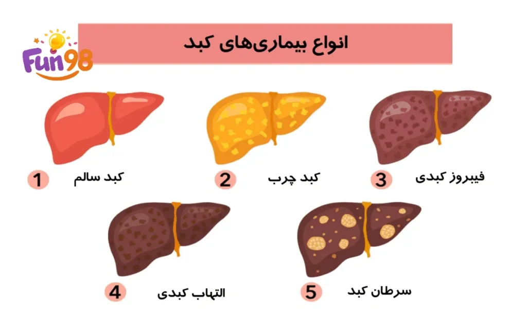 کبد چرب چیست؟