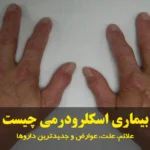 بیماری اسکلرودرمی چیست