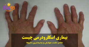 بیماری اسکلرودرمی چیست