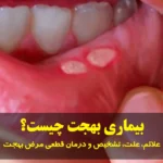 بیماری بهجت چیست؟ علائم، علت، تشخیص و درمان قطعی