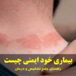 بیماری خود ایمنی