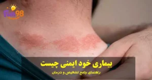 بیماری خود ایمنی