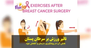 تاثیر ورزش بر سرطان پستان