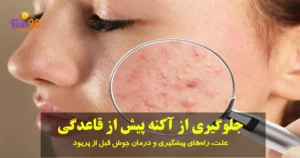 چه کار کنیم قبل از پریودی جوش نزنیم