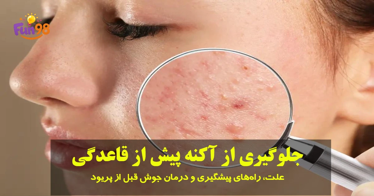 چه کار کنیم قبل از پریودی جوش نزنیم