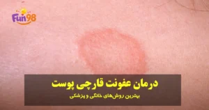 درمان عفونت قارچی پوست