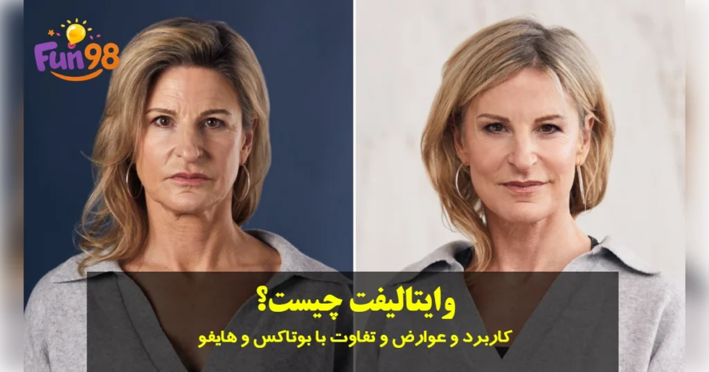 وایتالیفت چیست