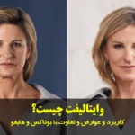 وایتالیفت چیست
